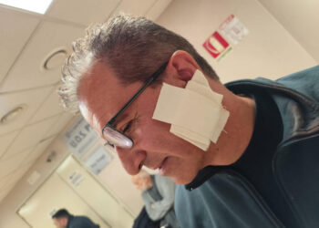Quarto (Na), Nonno (FdI): Solidarietà totale al lavoratore ferito con un machete»
